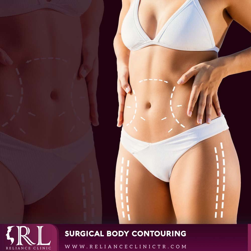 surgical body contouring